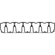 Joint de cache culbuteurs VICTOR REINZ [71-34869-00]