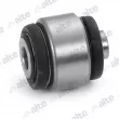 Silent bloc de suspension (train avant) ALTE AUTOMOTIVE [86330AL]
