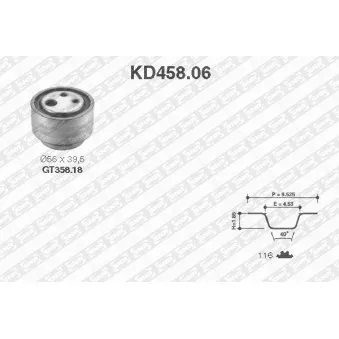 Kit de distribution SNR KD458.06